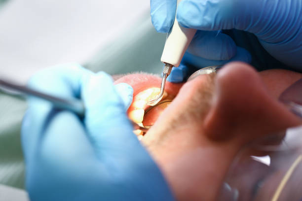 Best Emergency Tooth Extraction in Paden City, WV
