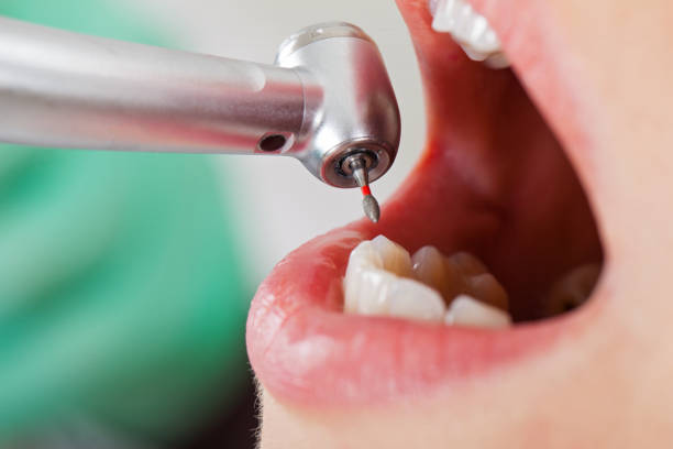 Best Emergency Treatment for Toothache in Paden City, WV